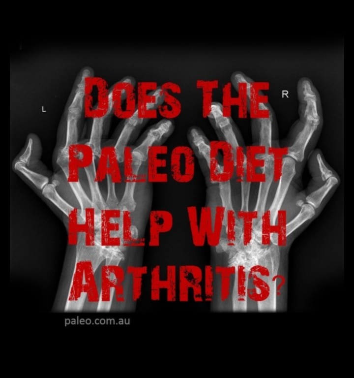 Paleolīta diētas ietekme uz locītavu veselību